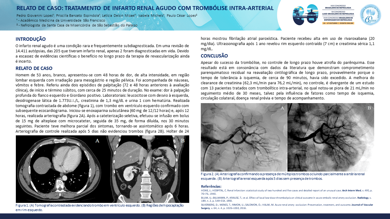 RELATO DE CASO: TRATAMENTO DE INFARTO RENAL AGUDO COM TROMBÓLISE INTRA-ARTERIAL