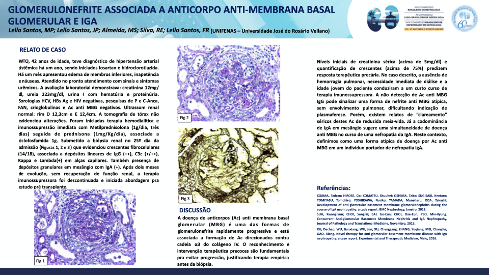 GLOMERULONEFRITE ASSOCIADA A ANTICORPO ANTI-MEMBRANA BASAL GLOMERULAR E IGA.