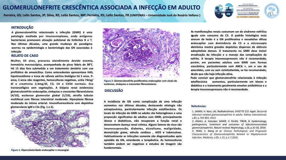 GLOMERULONEFRITE CRESCÊNTICA ASSOCIADA A INFECÇÃO EM ADULTO