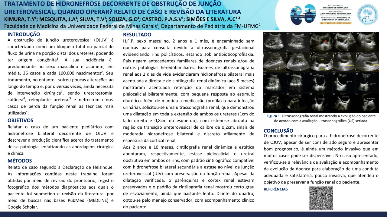 TRATAMENTO DE HIDRONEFROSE DECORRENTE DE OBSTRUÇÃO DE JUNÇÃO URETEROVESICAL, QUANDO OPERAR? RELATO DE CASO E REVISÃO DA LITERATURA