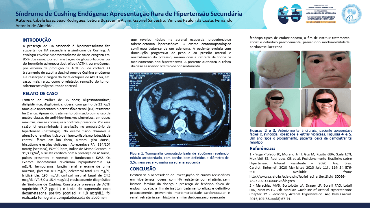 SÍNDROME DE CUSHING ENDÓGENA: APRESENTAÇÃO RARA DE HIPERTENSÃO SECUNDÁRIA