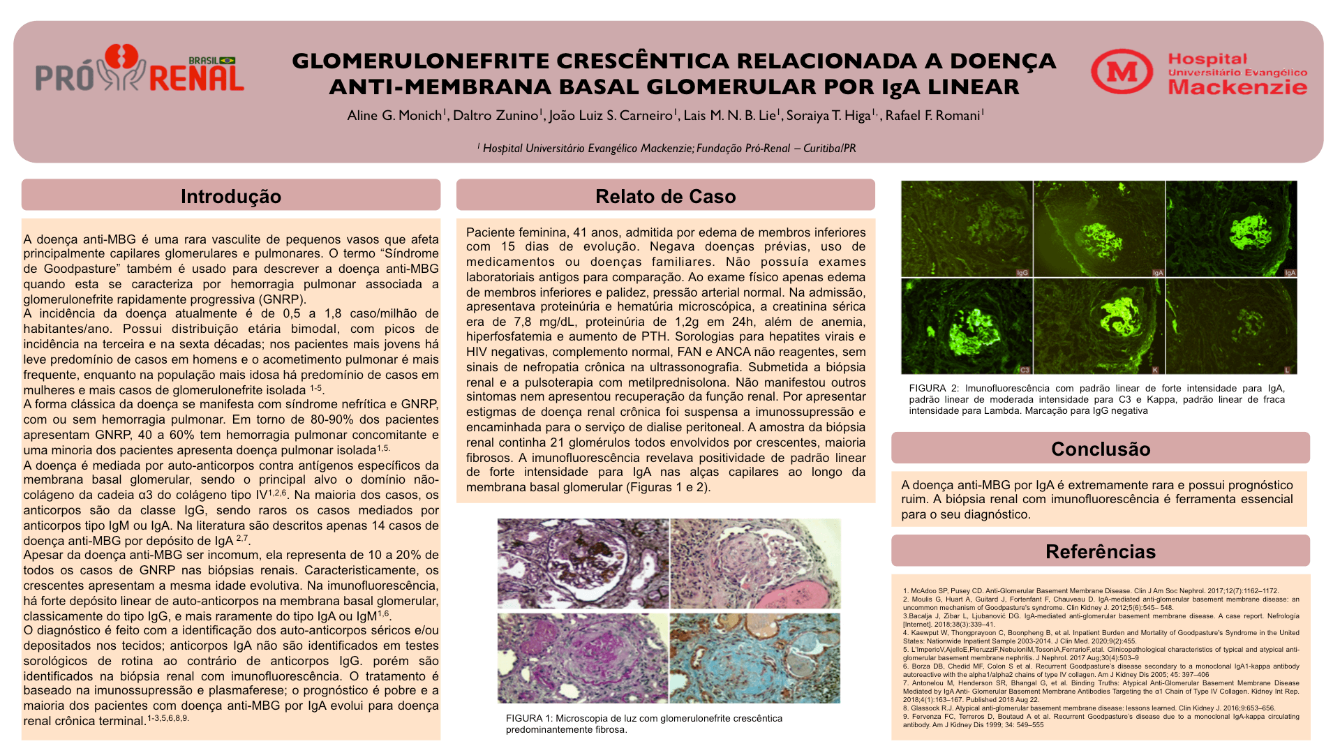 GLOMERULONEFRITE CRESCÊNTICA RELACIONADA A DOENÇA ANTI-MEMBRANA BASAL GLOMERULAR POR IGA LINEAR