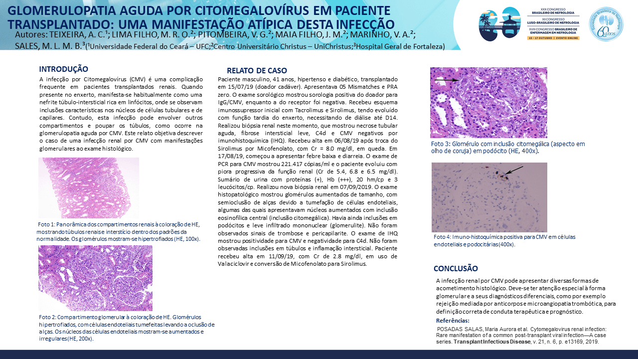 GLOMERULOPATIA AGUDA POR CITOMEGALOVÍRUS EM PACIENTE TRANSPLANTADO: UMA MANIFESTAÇÃO ATÍPICA DESTA INFECÇÃO