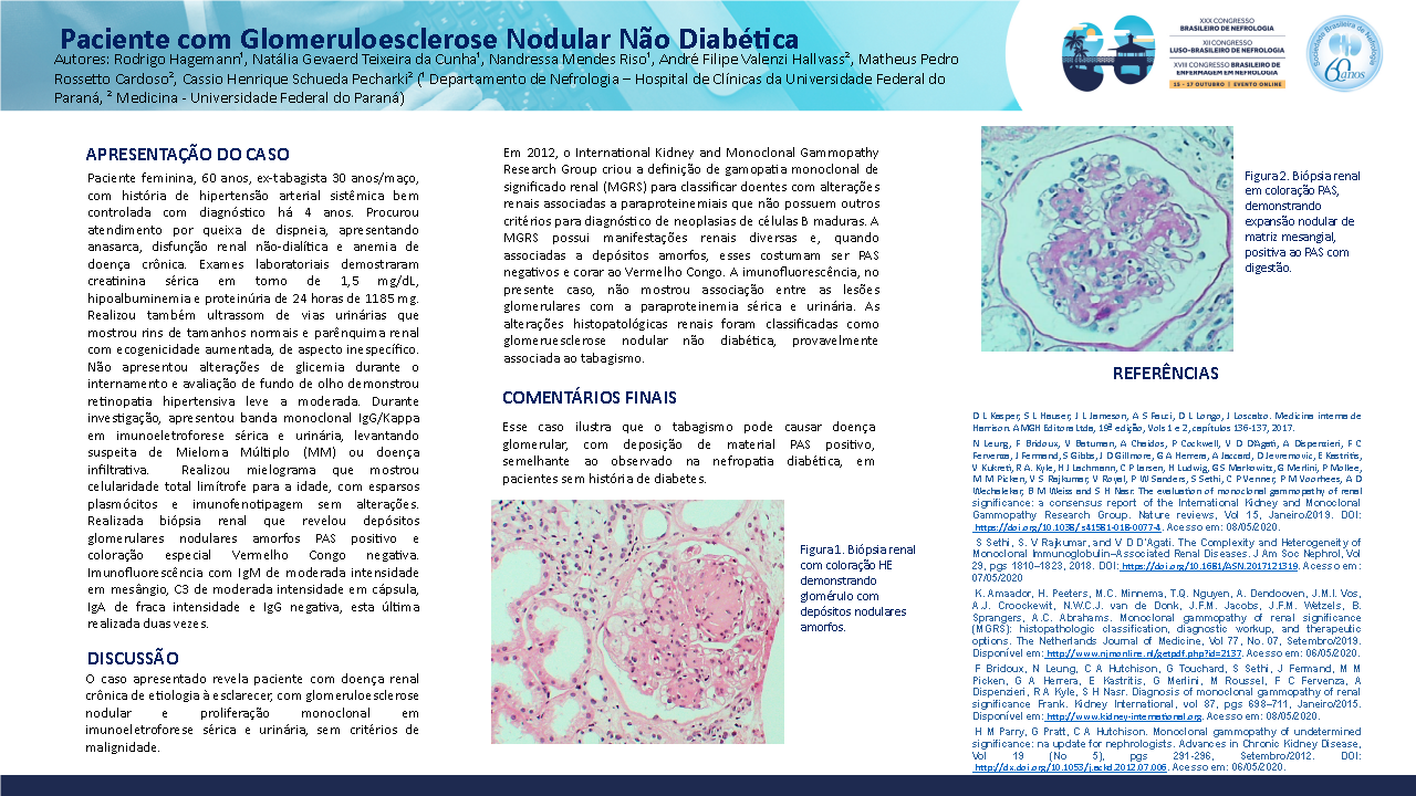 PACIENTE COM GLOMERULOESCLEROSE NODULAR NÃO DIABÉTICA