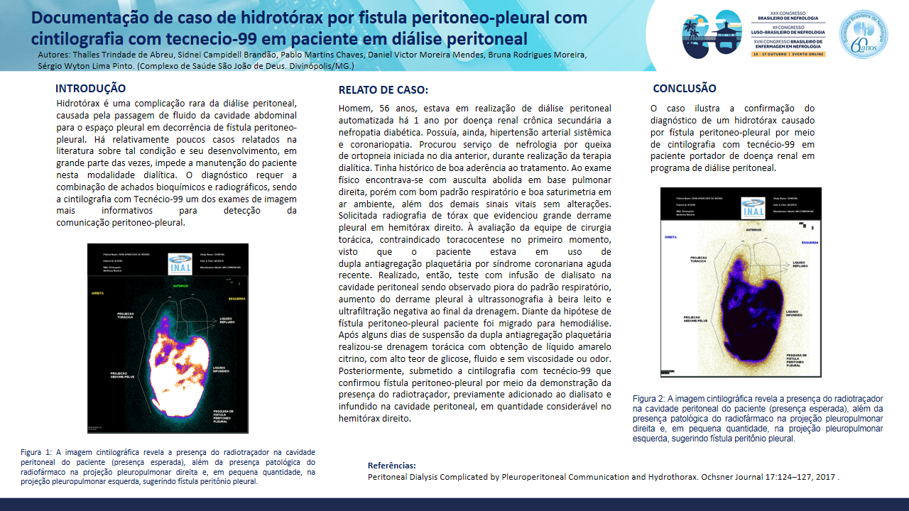 DOCUMENTAÇÃO DE CASO DE HIDROTÓRAX POR FISTULA PERITONEO-PLEURAL COM CINTILOGRAFIA COM TECNECIO-99 EM PACIENTE EM DIÁLISE PERITONEAL