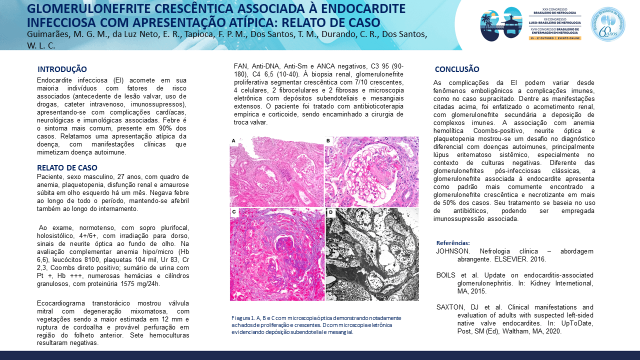 GLOMERULONEFRITE CRESCÊNTICA ASSOCIADA À ENDOCARDITE INFECCIOSA COM APRESENTAÇÃO ATÍPICA: RELATO DE CASO