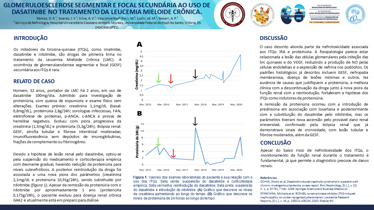 GLOMERULOESCLEROSE SEGMENTAR E FOCAL SECUNDÁRIA AO USO DE DASATINIBE NO TRATAMENTO DA LEUCEMIA MIELOIDE CRÔNICA.