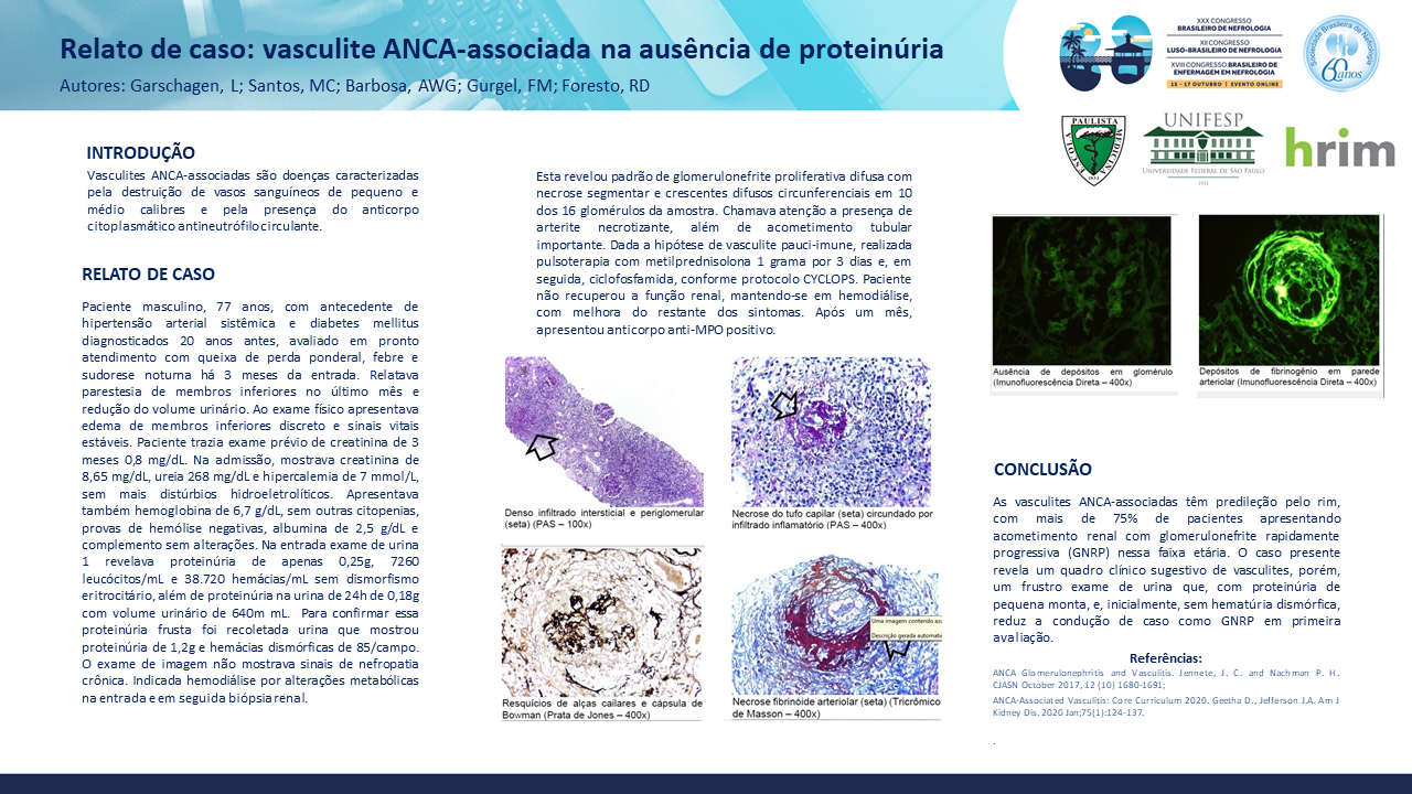 VASCULITE ANCA-ASSOCIADA NA AUSÊNCIA DE PROTEINÚRIA