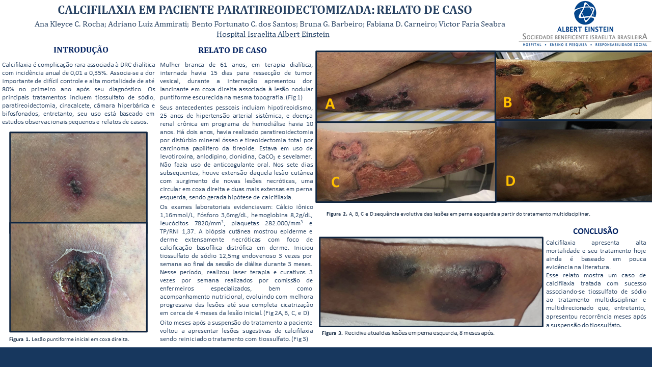 CALCIFILAXIA EM PACIENTE PARATIREOIDECTOMIZADA: RELATO DE CASO