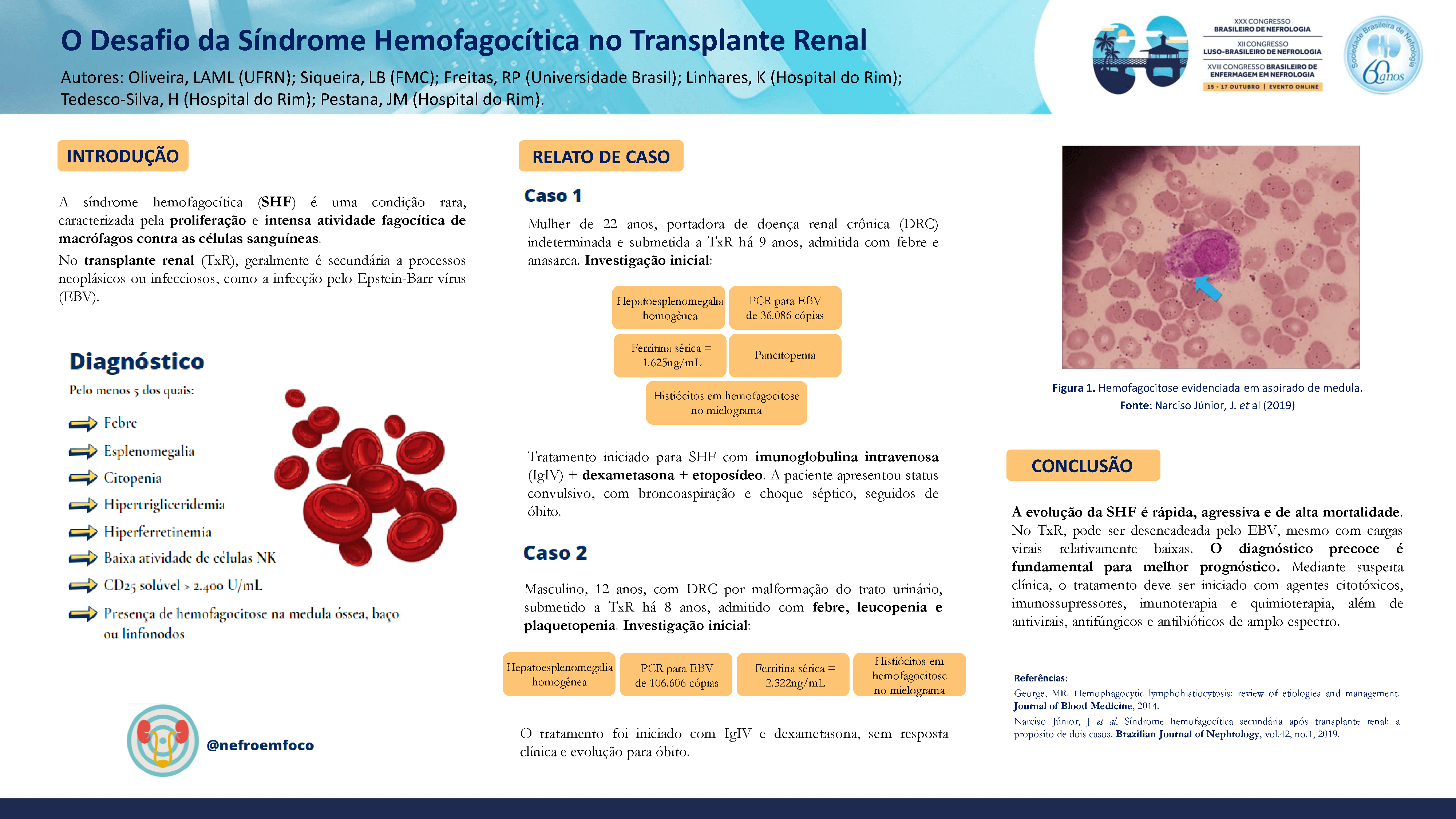 O DESAFIO DA SÍNDROME HEMOFAGOCÍTICA NO TRANSPLANTE RENAL