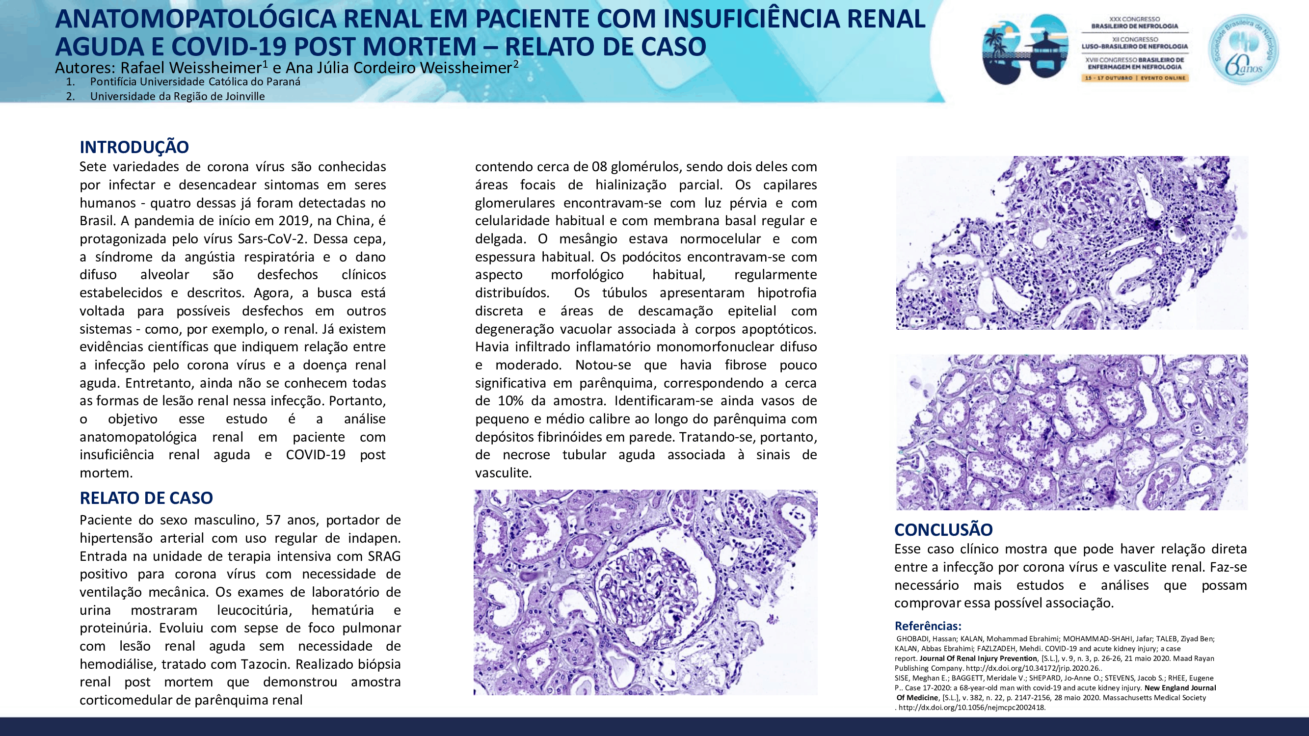 ANATOMOPATOLÓGICA RENAL EM PACIENTE COM INSUFICIÊNCIA RENAL AGUDA E COVID-19 POST MORTEM - RELATO DE CASO