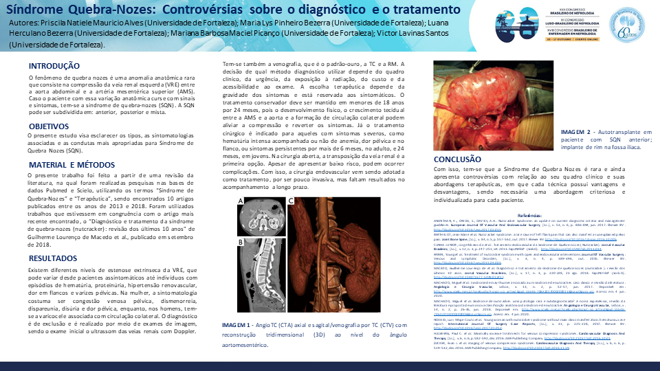 SÍNDROME QUEBRA-NOZES: CONTROVÉRSIAS SOBRE DIAGNÓSTICO E TRATAMENTO