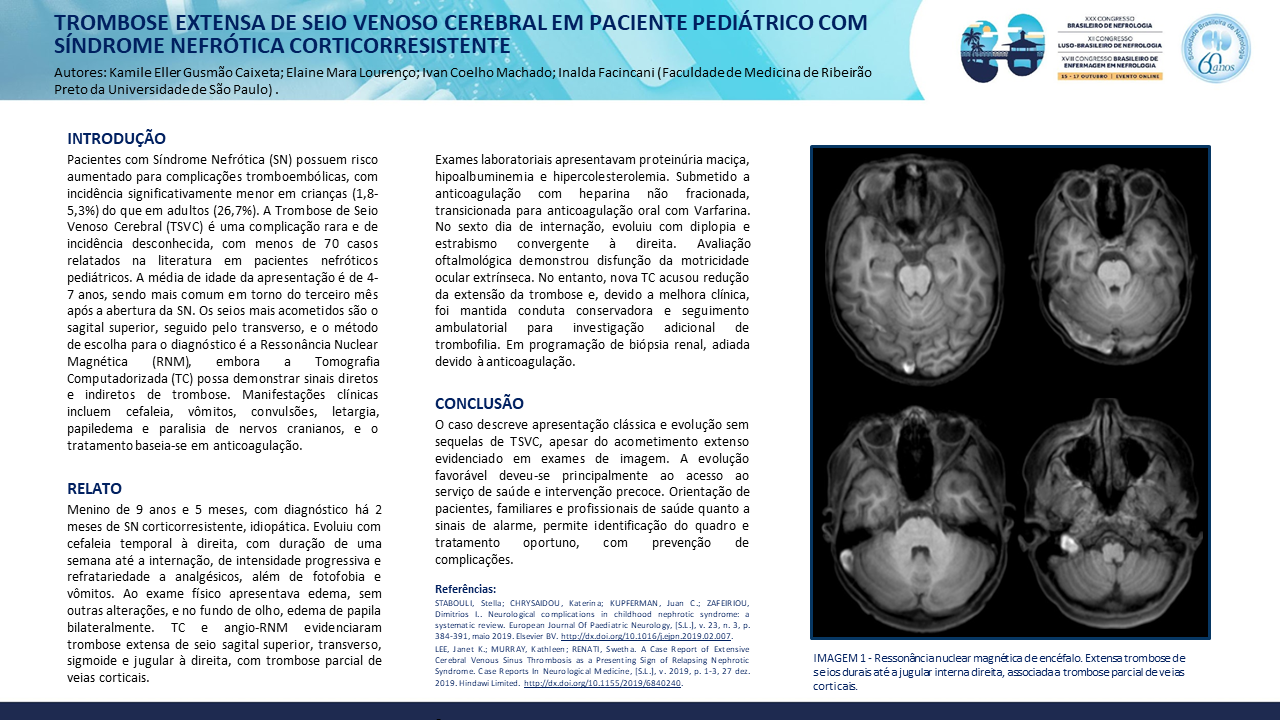 TROMBOSE EXTENSA DE SEIO VENOSO CEREBRAL EM PACIENTE PEDIÁTRICO COM SÍNDROME NEFRÓTICA CORTICORRESISTENTE