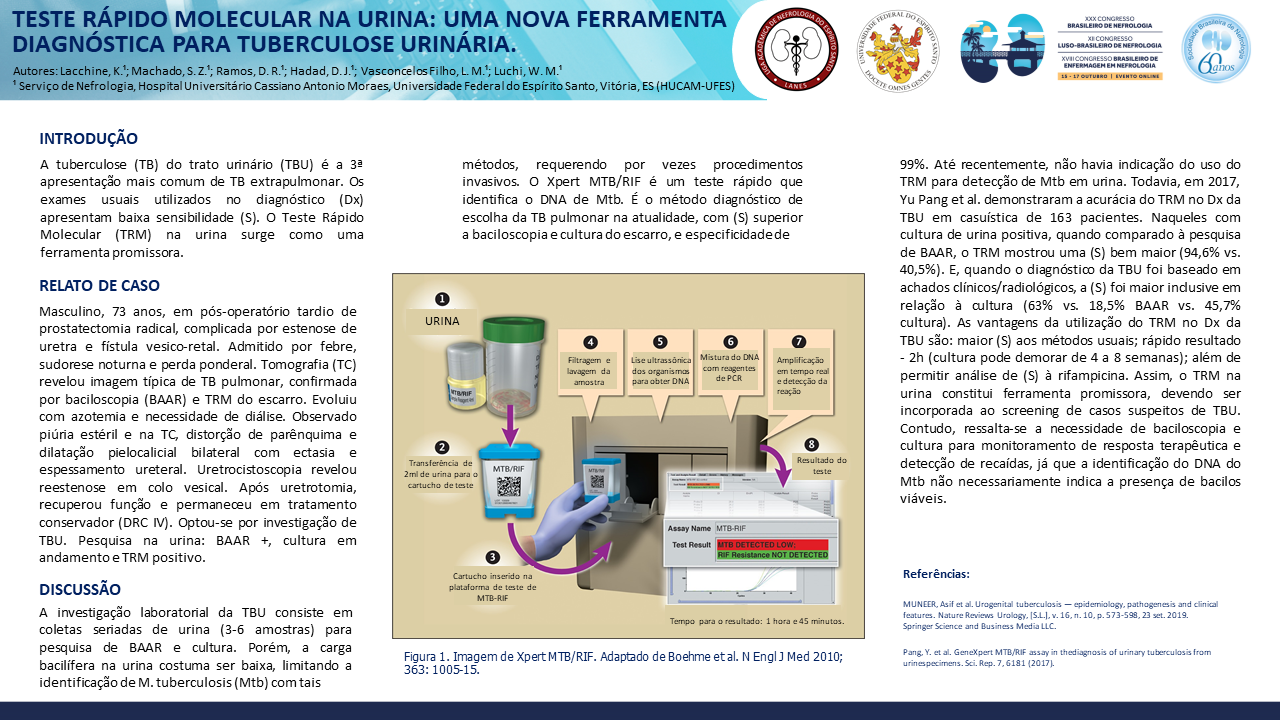 TESTE RÁPIDO MOLECULAR NA URINA: UMA NOVA FERRAMENTA DIAGNÓSTICA PARA TUBERCULOSE URINÁRIA