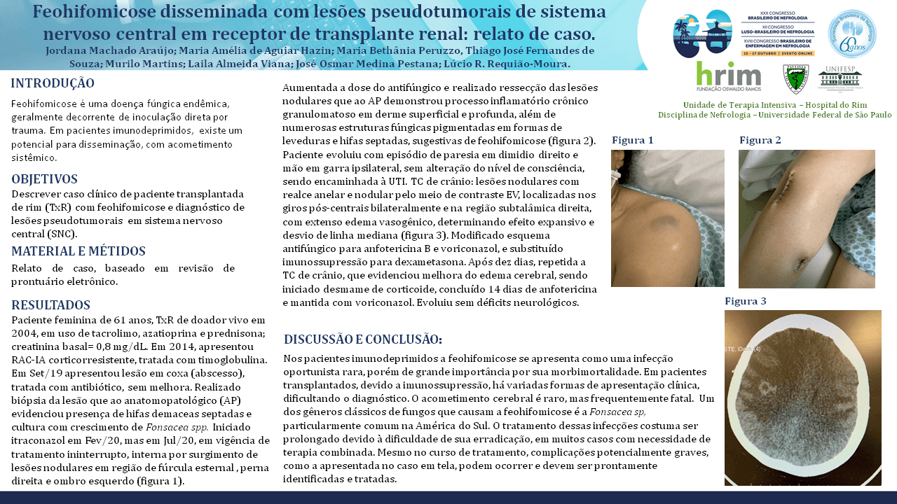 FEOHIFOMICOSE DISSEMINADA COM LESÕES PSEUDOTUMORAIS DE SISTEMA NERVOSO CENTRAL EM RECEPTOR DE TRANSPLANTE RENAL: RELATO DE CASO.