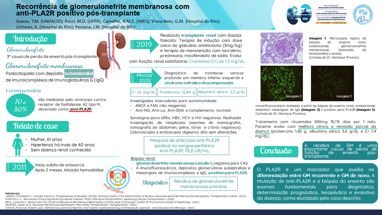 RECORRÊNCIA DE GLOMERULONEFRITE MEMBRANOSA COM ANTI-PLA2R POSITIVO PÓS-TRANSPLANTE