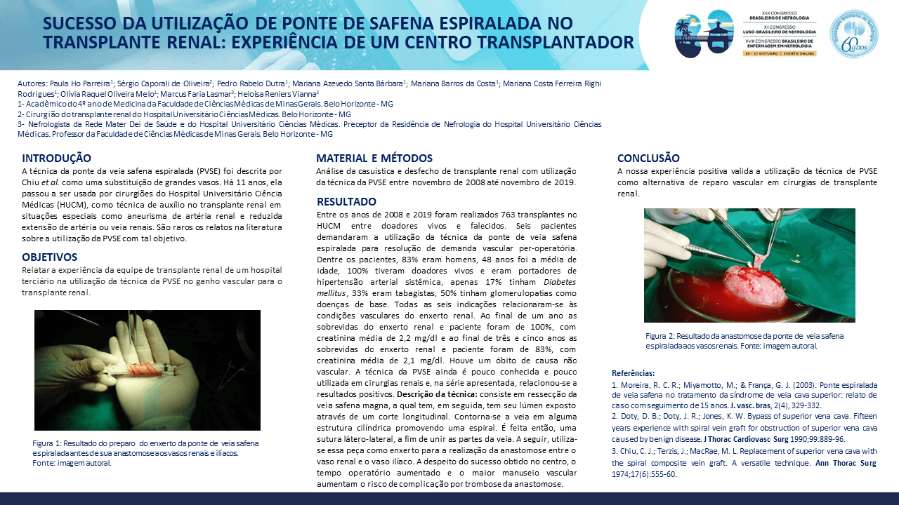 SUCESSO DA UTILIZAÇÃO DE PONTE DE SAFENA ESPIRALADA NO TRANSPLANTE RENAL: EXPERIÊNCIA DE UM CENTRO TRANSPLANTADOR