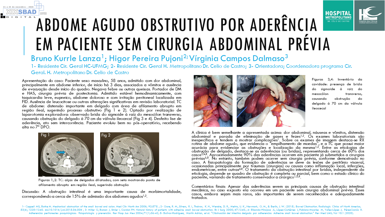 ABDOME AGUDO - Cirurgia Geral I