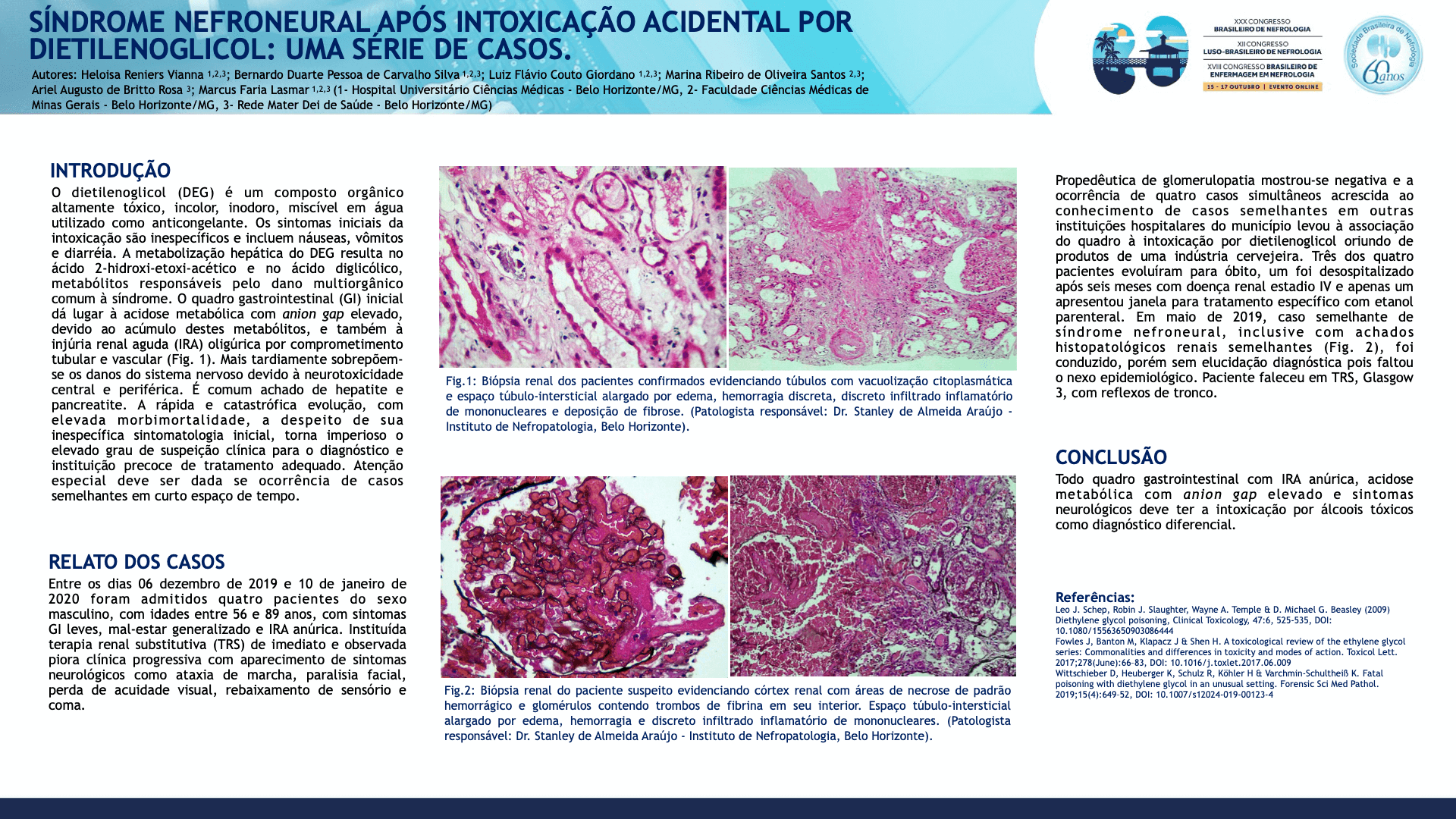 SÍNDROME NEFRONEURAL APÓS INTOXICAÇÃO ACIDENTAL POR DIETILENOGLICOL: UMA SÉRIE DE CASOS