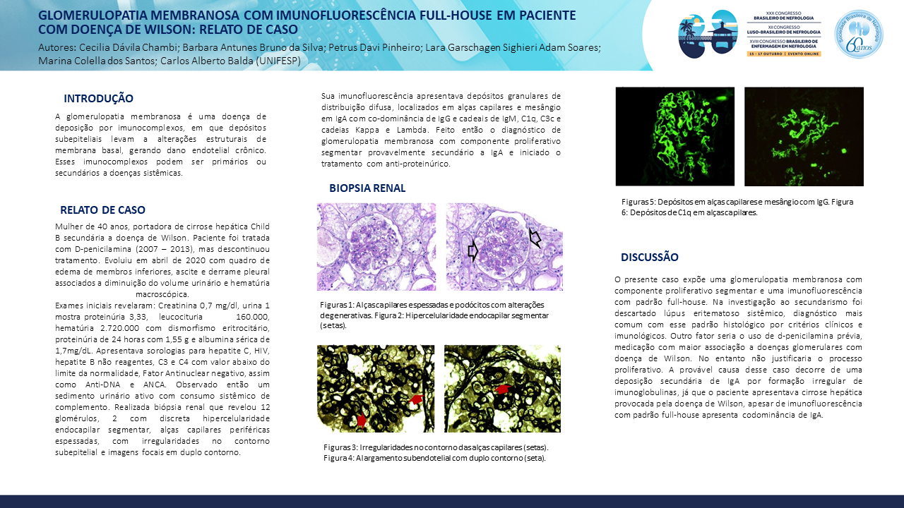 GLOMERULOPATIA MEMBRANOSA COM IMUNOFLUORESCÊNCIA FULL-HOUSE EM PACIENTE COM DOENÇA DE WILSON: RELATO DE CASO